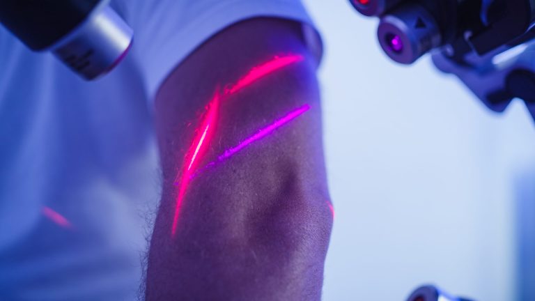 Cold Laser Therapy