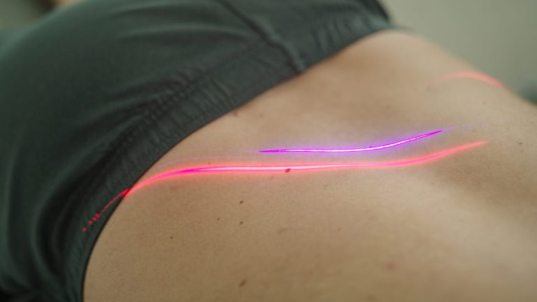 Cold Laser Therapy
