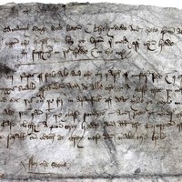 Head Pain And Headaches